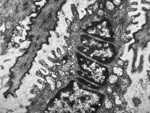 contracted smooth muscle cells in an intestinal villus contracted smooth muscle cells in an intestinal villus